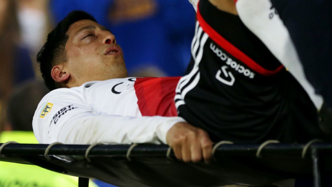 Rodrigo Aliendro has fractured his facial bones and will undergo surgery in the coming days.