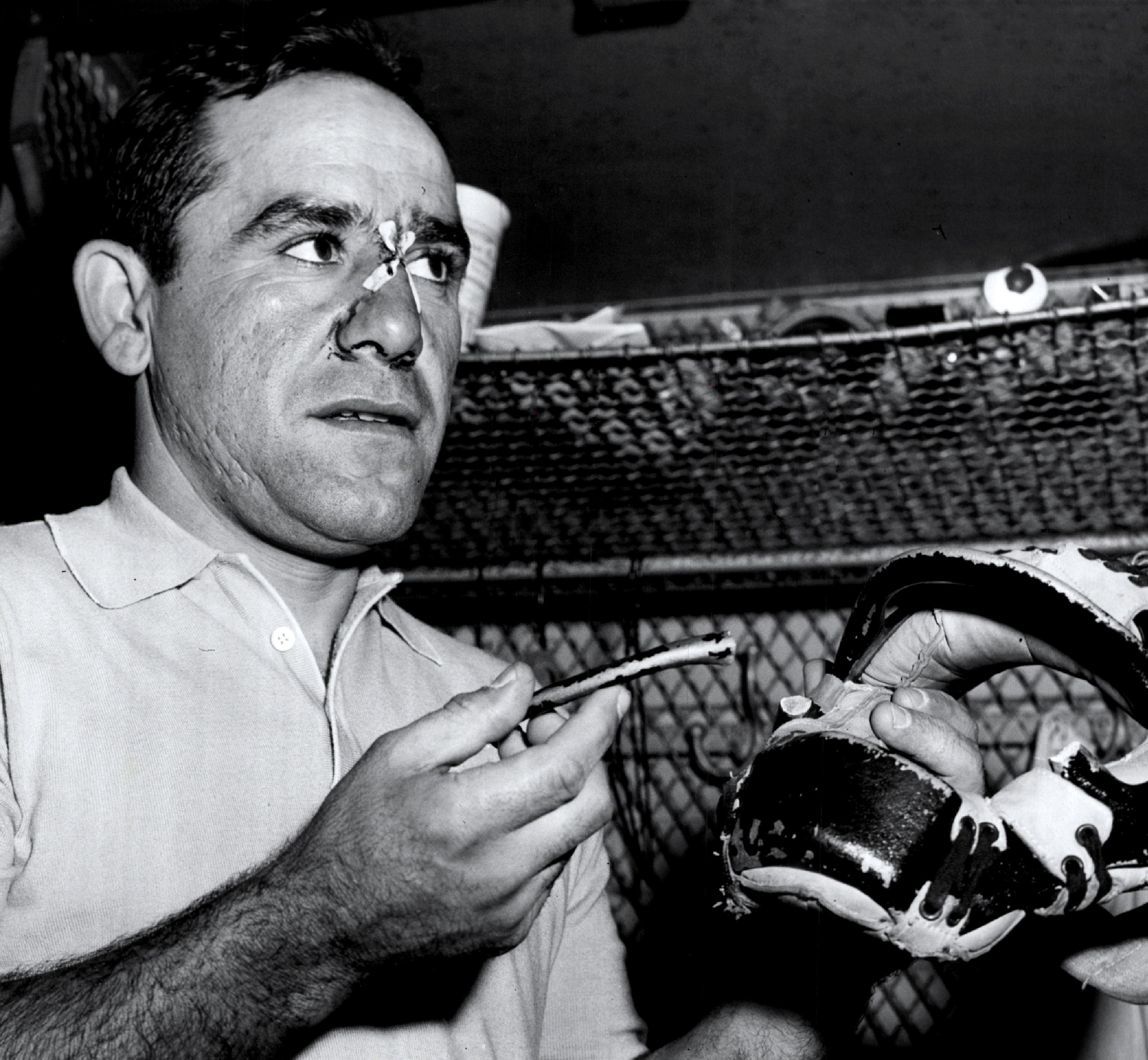 Yogi Berra's fractured nose