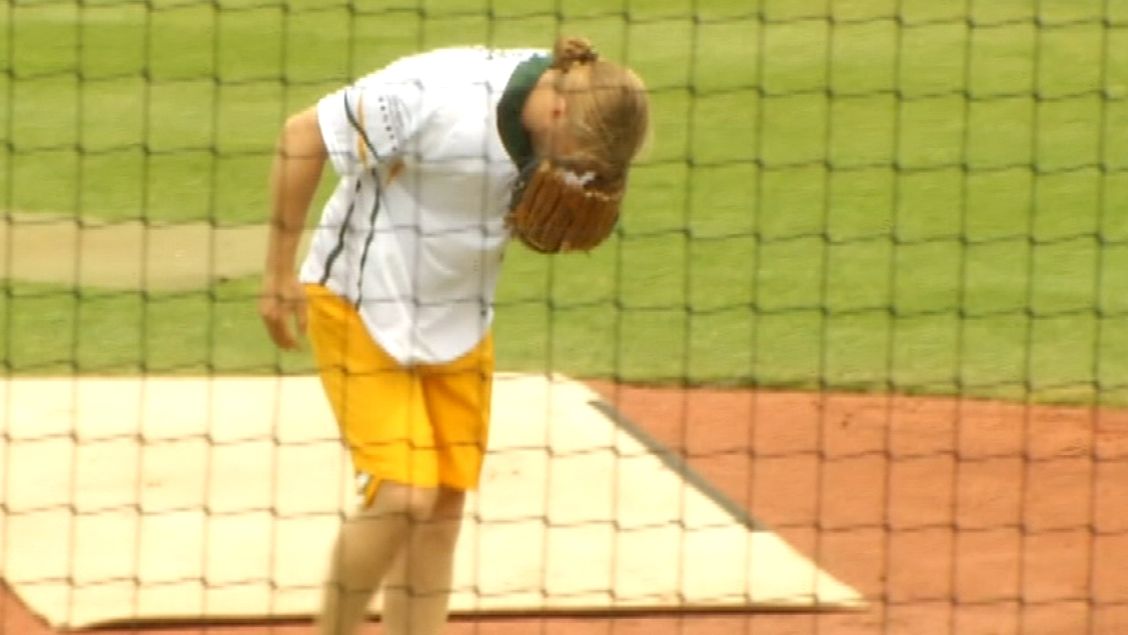 Clay Matthews taken to ER after freak softball injury (Video)