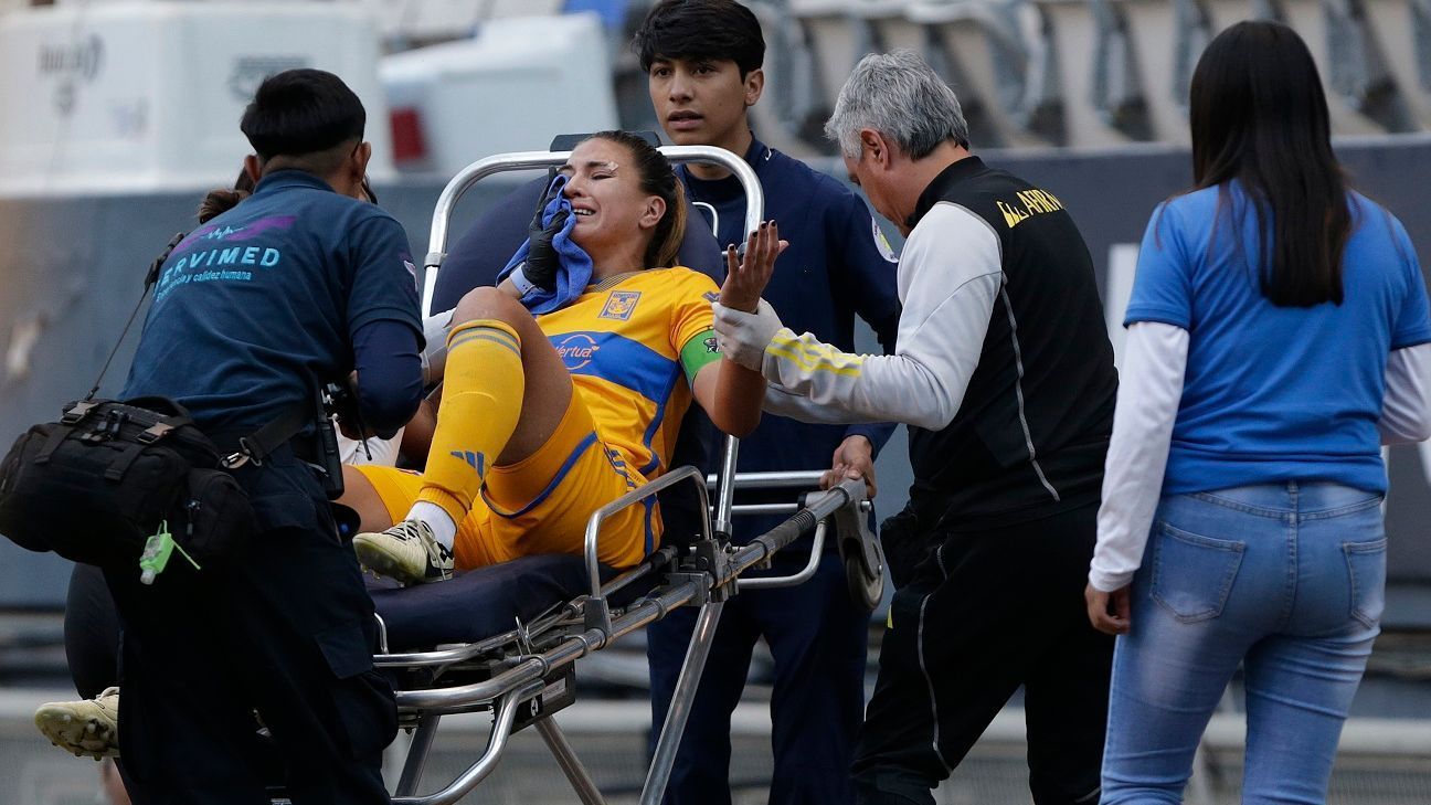 Tigres Feminil: Nayli Rangel przechodzi operację po złamaniu w wyniku uderzenia w głowę.